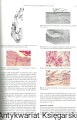 patologia jamy SANMEDICA5.jpg