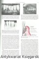 patologia przyzebia SANMEDICA4.jpg