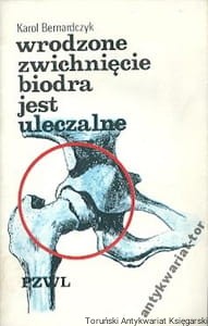 Wrodzone zwichnięcie biodra jest uleczalne / Karol Bernardczyk